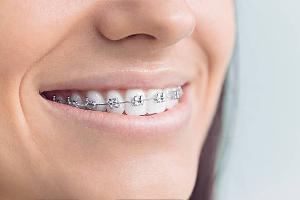 Best Teeth Whitening  in , DC